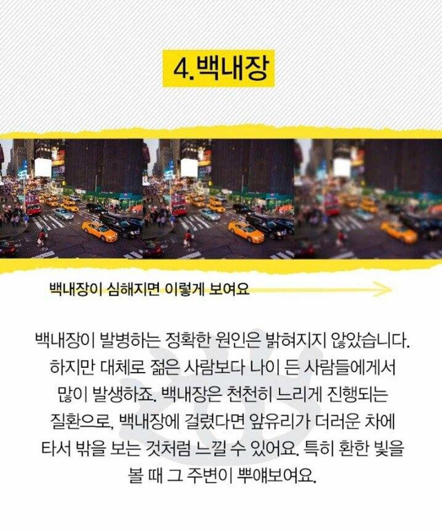 눈으로 알 수 있는 질병 | 인스티즈