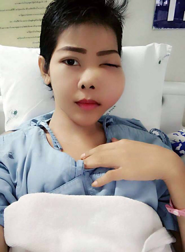 얼굴에 종양이 생긴 태국녀 ㅠㅜ | 인스티즈