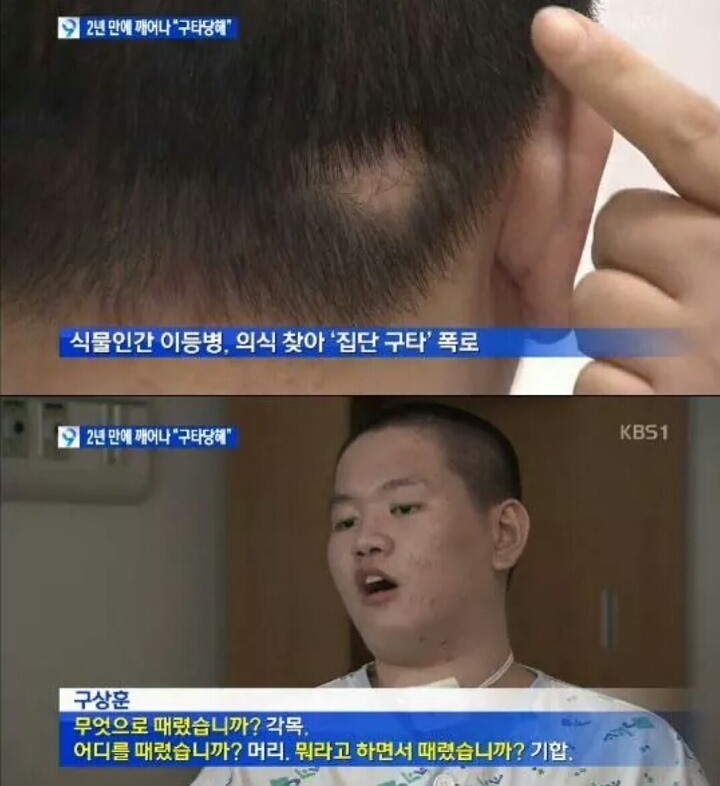 군대에서 식물인간이되서 2년만에 깨어난 청년의한마디 | 인스티즈