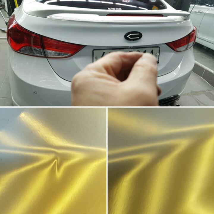 덴트 이미지