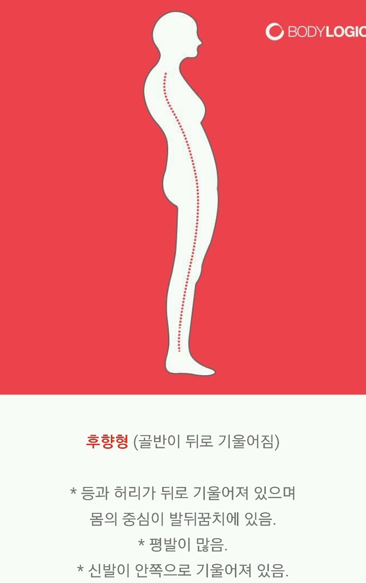 제자리걸음으로 골반틀어짐 확인하는 법 | 인스티즈
