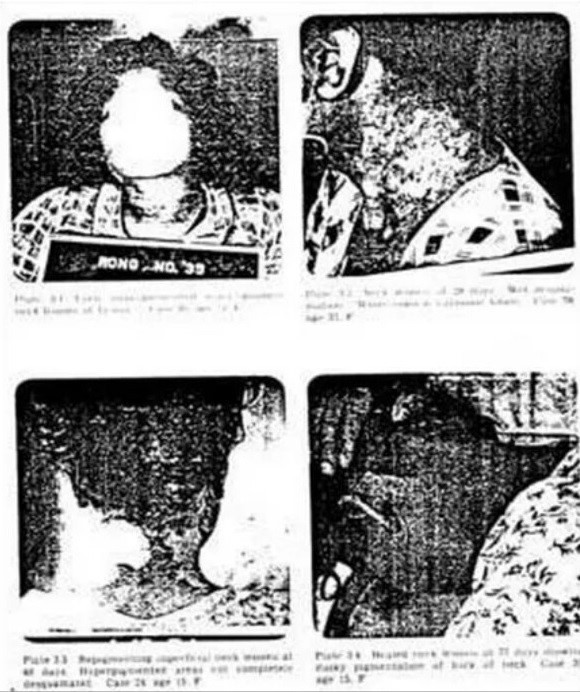 세계 10대 최악의 실험 | 인스티즈