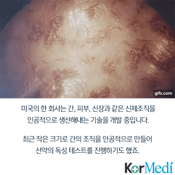 당신의 미래가 사이보그라면?: 미래 의료 신기술 | 인스티즈