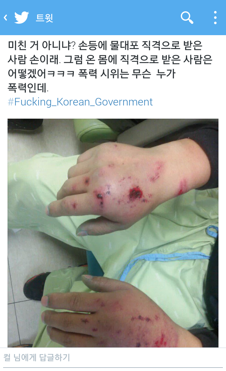 물대포 직격으로 맞은 사람의 손 | 인스티즈