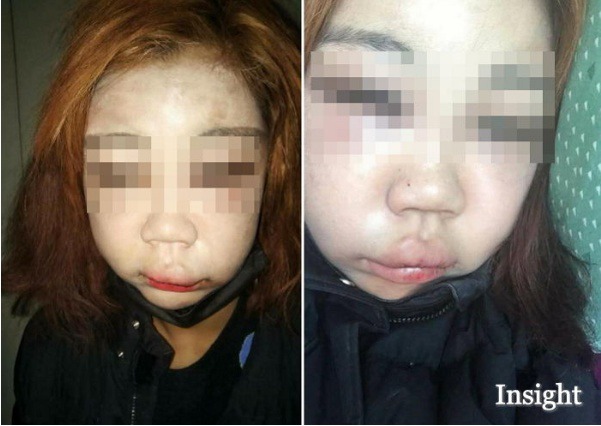 여고생 폭행하다 명품옷에 피 튀기자 45만원 내놓으라며 또 구타한 남성 | 인스티즈