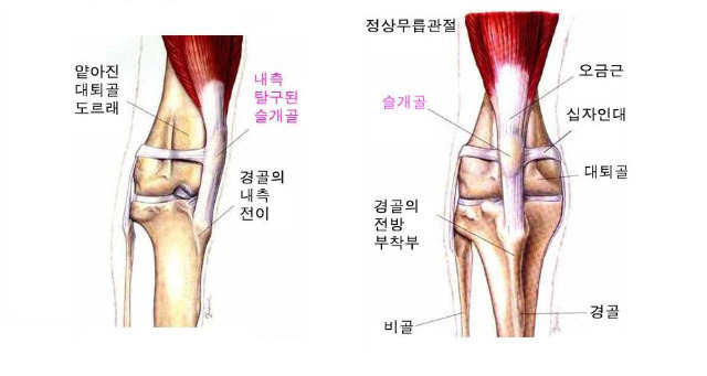 소형견들이 공통적으로 가지고 있는 유전질환 | 인스티즈