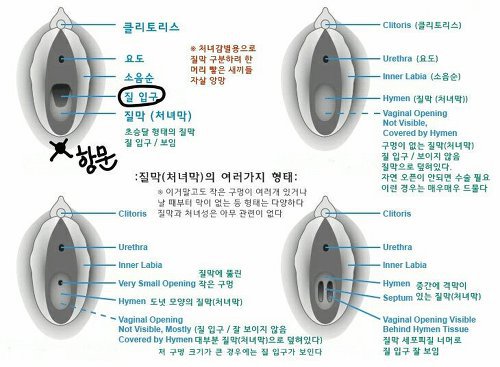 너네 * 쳐녀막 대체어 * 프로젝트 진행된거 혹시 알고 있니?(성에 대해 궁금하고 무지해도 다 들어와라) | 인스티즈