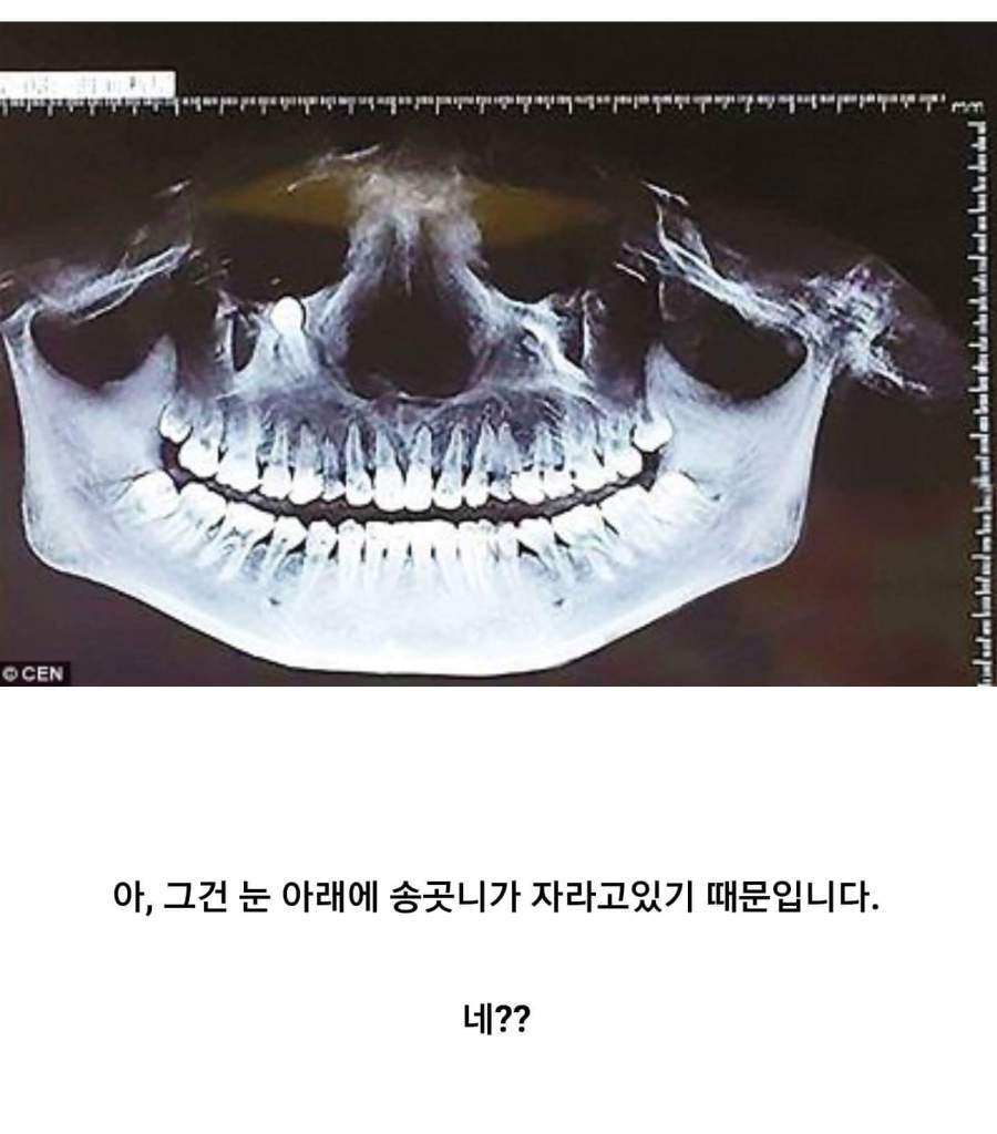  의사선생님 눈 밑이 너무 아픈데 어떡하죠? | 인스티즈